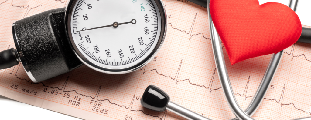 O que é hipertensão arterial?

A hipertensão arterial, popularmente conhecida como pressão alta, é uma condição crônica caracterizada pelo aumento persistente da pressão do sangue contra as paredes das artérias.

Considera-se hipertensão quando os níveis estão iguais ou acima de 140 x 90 mmHg, de forma recorrente.

É uma das doenças crônicas mais prevalentes no mundo e um dos principais fatores de risco para doenças cardiovasculares, AVC e insuficiência renal.

Por que a hipertensão arterial é tão perigosa?

A hipertensão arterial é chamada de “doença silenciosa” porque, na maioria das vezes, não apresenta sintomas claros. Muitas pessoas convivem com pressão alta por anos sem saber.

Quando não controlada, pode causar:

Infarto

Acidente vascular cerebral (AVC)

Insuficiência cardíaca

Doença renal crônica

Alterações na visão

Aneurismas

O controle adequado reduz significativamente esses riscos.

Principais causas da hipertensão arterial

A pressão alta pode ter múltiplos fatores envolvidos:

1. Excesso de peso

O aumento da gordura corporal eleva a resistência vascular.

2. Consumo excessivo de sal

O sódio favorece retenção de líquidos e aumento da pressão.

3. Sedentarismo

A falta de atividade física prejudica o controle vascular.

4. Resistência à insulina

Muito comum em pessoas com síndrome metabólica.

5. Histórico familiar

A predisposição genética influencia, mas não determina.

6. Estresse crônico

Eleva cortisol e adrenalina, impactando a pressão.

7. Consumo excessivo de álcool
Sintomas de pressão alta

Na maioria dos casos, a hipertensão arterial não apresenta sintomas. Porém, quando ocorrem, podem incluir:

Dor de cabeça frequente

Tontura

Zumbido no ouvido

Visão turva

Sangramento nasal

Palpitações

Esses sintomas geralmente aparecem quando a pressão já está muito elevada.

Como é feito o diagnóstico?

O diagnóstico é realizado por meio da aferição regular da pressão arterial.

Pode ser feito através de:

Medição em consultório

MAPA (Monitorização Ambulatorial da Pressão Arterial)

MRPA (Medição Residencial da Pressão Arterial)

O acompanhamento médico é essencial para confirmar o diagnóstico.

Como baixar a pressão naturalmente?

O tratamento da hipertensão arterial envolve mudanças no estilo de vida e, em alguns casos, uso de medicamentos.

As estratégias naturais incluem:

1. Redução do consumo de sal

A recomendação é consumir no máximo 5g de sal por dia (aproximadamente 1 colher de chá).

Evitar:

Embutidos

Temperos industrializados

Enlatados

Ultraprocessados

2. Aumento do consumo de alimentos ricos em potássio

O potássio ajuda a equilibrar os efeitos do sódio.

Boas fontes:

Banana

Abacate

Espinafre

Feijão

Água de coco

3. Controle do peso corporal

A perda de 5% a 10% do peso já reduz significativamente os níveis pressóricos.

4. Exercício físico regular

A prática de:

Musculação

Caminhada

Treino aeróbico moderado

Melhora a função vascular e reduz a pressão arterial.

5. Controle da resistência à insulina

Reduzir açúcar e carboidratos refinados ajuda no equilíbrio metabólico.

6. Manejo do estresse

Técnicas como:

Respiração consciente

Meditação

Sono adequado

São fundamentais no controle da pressão arterial.

Alimentação para hipertensão arterial

Uma alimentação estratégica inclui:

Verduras e legumes diariamente

Frutas com moderação

Proteínas magras

Oleaginosas

Azeite de oliva

Redução de ultraprocessados

O padrão alimentar semelhante à dieta DASH apresenta excelentes resultados no controle da pressão.

Suplementos que podem auxiliar no controle da pressão

Alguns nutrientes podem ser considerados, com acompanhamento profissional:

Magnésio

Ômega 3

Coenzima Q10

Potássio (em casos específicos)

Vitamina D

A suplementação deve ser individualizada e baseada em exames laboratoriais.

Quem tem hipertensão precisa cortar totalmente o sal?

Não necessariamente eliminar, mas controlar rigorosamente.

O maior problema não é o sal de adição, mas o sódio oculto nos alimentos industrializados.

Hipertensão tem cura?

Na maioria dos casos, a hipertensão arterial não tem “cura”, mas tem controle.

Muitos pacientes conseguem reduzir ou até suspender medicação quando:

Perdem peso

Melhoram alimentação

Praticam atividade física

Controlam estresse

Mas isso deve ser feito com acompanhamento médico.

O papel do nutricionista no controle da pressão

O acompanhamento nutricional permite:

Planejamento alimentar personalizado

Controle de sódio estratégico

Ajuste de macronutrientes

Monitoramento da evolução

Educação alimentar sustentável

Cada paciente apresenta necessidades diferentes.

FAQ – Perguntas frequentes sobre hipertensão arterial

Pressão 14 por 9 é perigosa?
É considerada limítrofe ou hipertensão estágio 1 e deve ser monitorada.

Café aumenta a pressão?
Pode elevar temporariamente, mas não é causa isolada de hipertensão crônica.

Quem tem pressão alta pode fazer musculação?
Sim, desde que orientado e com pressão controlada.

Água ajuda a baixar a pressão?
Hidratação adequada auxilia no equilíbrio vascular, mas não substitui tratamento.

Conclusão

A hipertensão arterial é uma condição comum, silenciosa e potencialmente grave. O diagnóstico precoce e o controle adequado reduzem significativamente o risco de complicações cardiovasculares.

Mudanças consistentes na alimentação, prática regular de exercícios e acompanhamento profissional são as estratégias mais eficazes para manter a pressão sob controle e preservar a saúde a longo prazo.