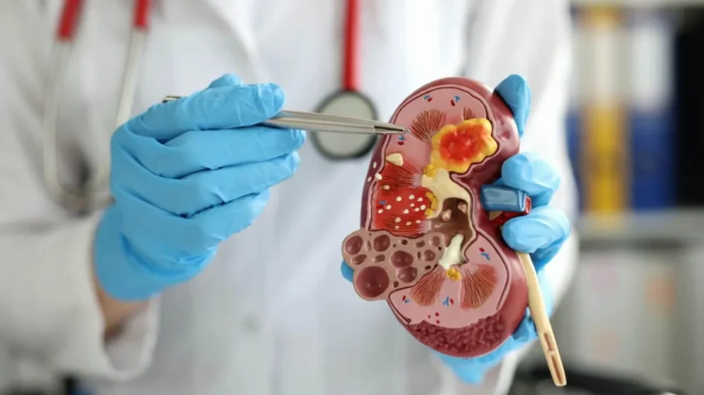 Doença Renal Silenciosa: 10 sinais que quase ninguém percebe (e quando procurar ajuda)
