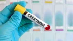 Creatinina alta: 12 causas comuns e o que fazer na prática para proteger seus rins