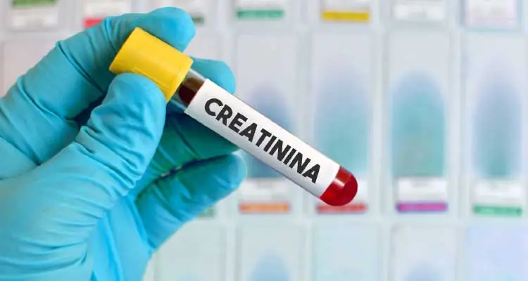 Creatinina Alta: 12 causas comuns e o que fazer na prática para proteger seus rins