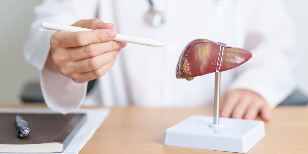 Gordura no fígado: causas, sintomas, riscos e como tratar de forma natural